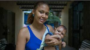 Zeke with microcephaly Fever in newborns